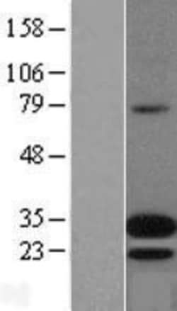 Novus Biologicals™ Adrenomedullin/ADM Overexpression Lysate
