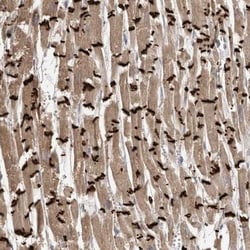 Adrenomedullin R/ADMR/GPR182 Antibody, Novus Biologicals 0.1mL; Unlabeled:Antibodies,