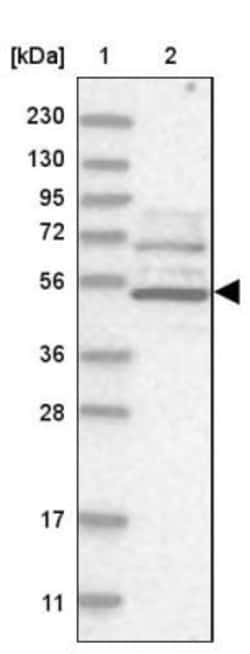 Adrenomedullin R/ADMR/GPR182 Antibody, Novus Biologicals 0.1mL; Unlabeled:Antibodies,