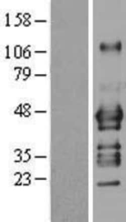 Novus Biologicals&trade;&nbsp;ADRM1 Overexpression Lysate