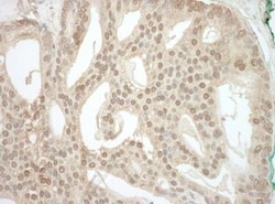 ADRM1 Antibody, Novus Biologicals 0.1mg; Unlabeled:Antibodies