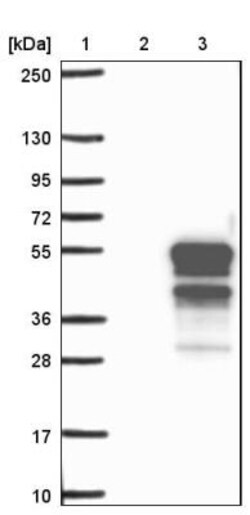 ADRM1 Antibody, Novus Biologicals 25 &mu;L | Buy Online | Novus Biologicals | Fisher Scientific