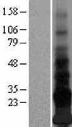 Novus Biologicals™ Adropin Overexpression Lysate