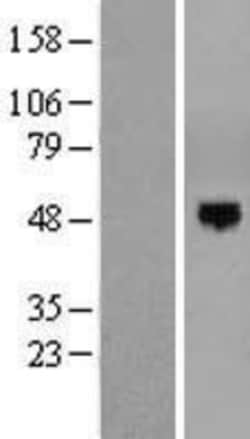 Novus Biologicals&trade;&nbsp;EOGT/AER61 Overexpression Lysate