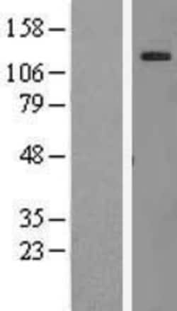 Novus Biologicals™ AF10 Overexpression Lysate