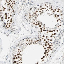 AF10 Antibody, Novus Biologicals 0.1mL; Unlabeled:Antibodies, Polyclonal