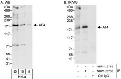 AF4 Antibody, Novus Biologicals 0.1mg; Unlabeled:Antibodies, Polyclonal