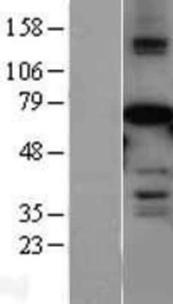 Novus Biologicals&trade;&nbsp;AF9 Overexpression Lysate