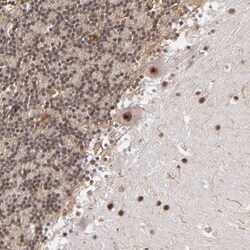 AF9 Antibody, Novus Biologicals 0.1mL; Unlabeled:Antibodies, Polyclonal