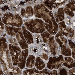 Afamin Antibody, Novus Biologicals 0.1mL; Unlabeled:Antibodies, Polyclonal