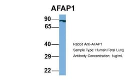AFAP Antibody, Novus Biologicals 20&mu;L; Unlabeled:Antibodies, Polyclonal