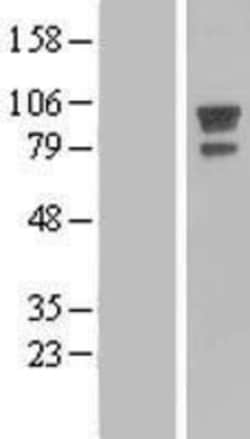 Novus Biologicals™ AFAP Overexpression Lysate