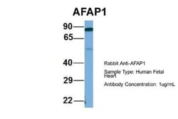 AFAP Antibody, Novus Biologicals 20&mu;L; Unlabeled:Antibodies, Polyclonal