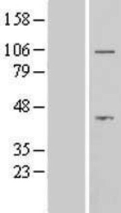 Novus Biologicals&trade;&nbsp;AFTPH Overexpression Lysate