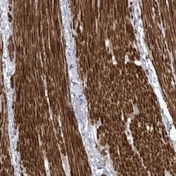 AFTPH Antibody, Novus Biologicals 0.1mL; Unlabeled:Antibodies, Polyclonal