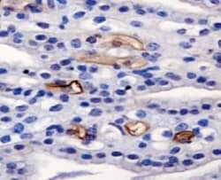 AG-2/AGR2 Antibody - BSA Free, Novus Biologicals 0.1mL; Unlabeled:Antibodies,