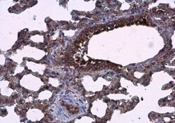 AG-3/AGR3 Antibody, Novus Biologicals 0.1mL; Unlabeled:Antibodies, Polyclonal