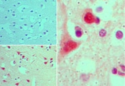 AGAP2 Antibody, Novus Biologicals 0.1mg; Unlabeled:Antibodies, Polyclonal