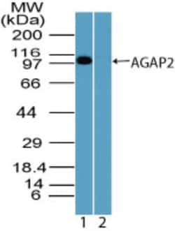 AGAP2 Antibody, Novus Biologicals 0.1mg; Unlabeled:Antibodies, Polyclonal