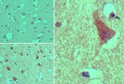 AGAP2 Antibody, Novus Biologicals 0.025mg; Unlabeled:Antibodies, Polyclonal