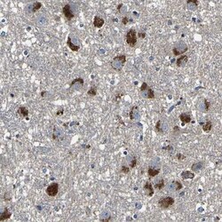 AGAP3 Antibody, Novus Biologicals:Antibodies:Primary Antibodies