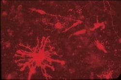Aggrecan Antibody (Cat-315), Novus Biologicals:Antibodies:Primary Antibodies