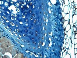 Aggrecan Neoepitope Antibody - BSA Free, Novus Biologicals:Antibodies:Primary
