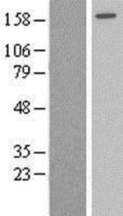 Novus Biologicals&trade;&nbsp;AGL Overexpression Lysate