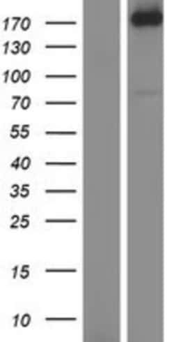 Novus Biologicals™ AGL Overexpression Lysate