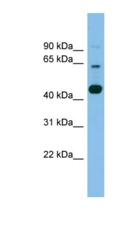 AGMO Antibody, Novus Biologicals 100&mu;L; Unlabeled:Antibodies, Polyclonal