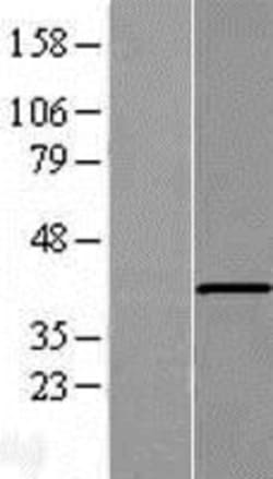 Novus Biologicals&trade;&nbsp;AGMO Overexpression Lysate