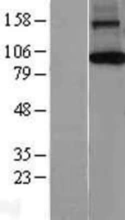 Novus Biologicals™ AGO1/EIF2C1 Overexpression Lysate