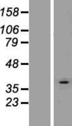 Novus Biologicals&trade;&nbsp;AGPAT3 Overexpression Lysate