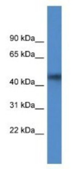 Agpat4 Antibody, Novus Biologicals 100μL; Unlabeled:Antibodies, Polyclonal