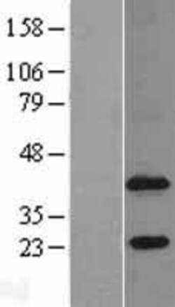 Novus Biologicals™ Agpat4 Overexpression Lysate