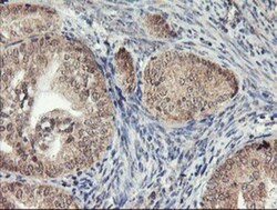 AGPAT5 Antibody (OTI2C4), Novus Biologicals 0.1mL; Unlabeled:Antibodies,