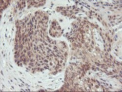AGPAT5 Antibody (OTI2C4), Novus Biologicals 0.1mL; Unlabeled:Antibodies,