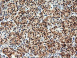 AGPAT5 Antibody (OTI2C4), Novus Biologicals 0.1mL; Unlabeled:Antibodies,
