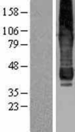 Novus Biologicals&trade;&nbsp;AGPAT6 Overexpression Lysate