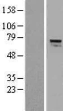 Novus Biologicals™ AGPS Overexpression Lysate