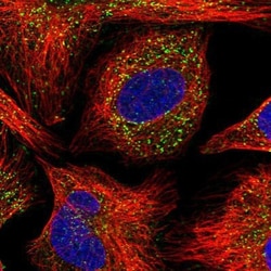 AGPS Antibody, Novus Biologicals 0.1mL; Unlabeled:Antibodies, Polyclonal