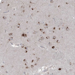 AGPS Antibody, Novus Biologicals 0.1mL; Unlabeled:Antibodies, Polyclonal
