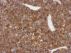 AG-3/AGR3 Antibody, Novus Biologicals 0.1mL; Unlabeled:Antibodies, Polyclonal