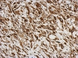 AG-3/AGR3 Antibody, Novus Biologicals 0.1mL; Unlabeled:Antibodies, Polyclonal