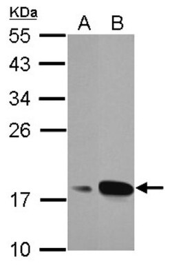 AG-3/AGR3 Antibody, Novus Biologicals 0.1mL; Unlabeled:Antibodies, Polyclonal