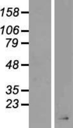 Novus Biologicals&trade;&nbsp;AgRP/ART Overexpression Lysate
