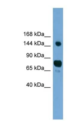 AGTPBP1 Antibody, Novus Biologicals 100&mu;L; Unlabeled:Antibodies, Polyclonal