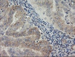 AGTPBP1 Antibody (OTI9A3), Novus Biologicals 0.1mL; Unlabeled:Antibodies,
