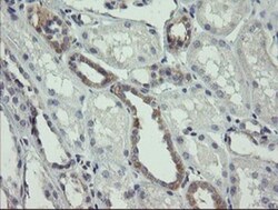 AGTPBP1 Antibody (OTI9A3), Novus Biologicals 0.1mL; Unlabeled:Antibodies,