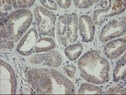 AGTPBP1 Antibody (OTI9A3), Novus Biologicals 0.1mL; Unlabeled:Antibodies,